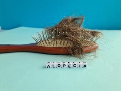 l’alopécie 